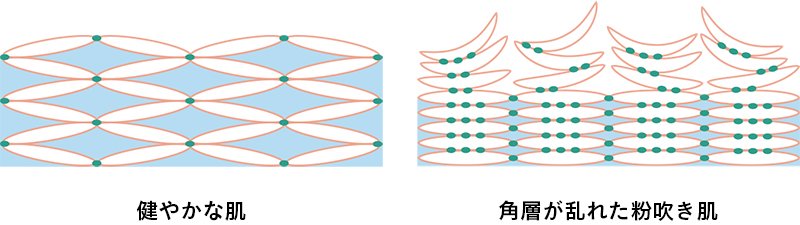 冬場 頬に粉が吹くのはなぜ Decencia ディセンシア 公式サイト