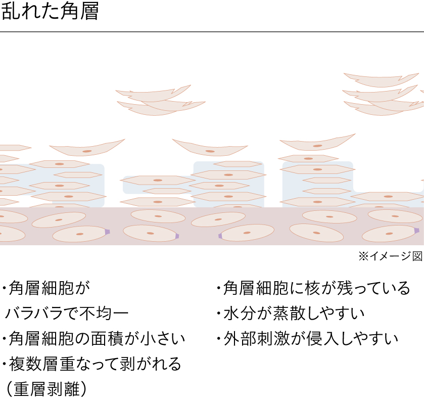 図解付き】美肌の要「角層」とは？役割とケア方法をわかりやすく