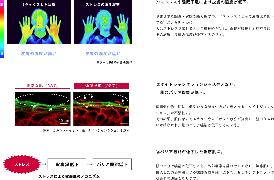 「ストレスによる敏感肌」のメカニズム