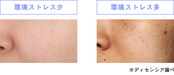 シミは精神的なストレスも原因だった!