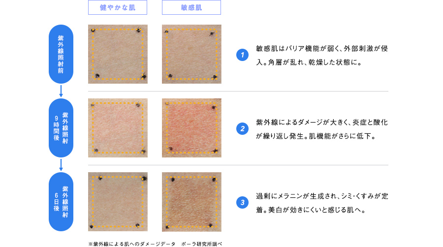 敏感肌は、炎症の繰り返しによって「シミ」のサイクルに陥っていた