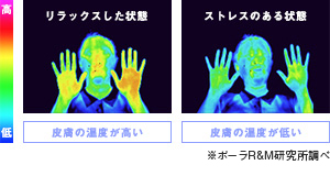 ストレスにより皮膚温が低下