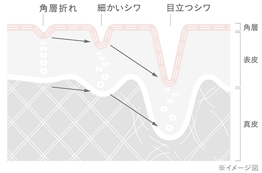 「角層折れ」ってなんですか？