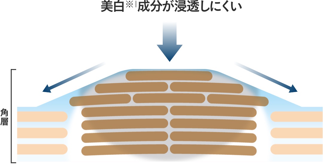 サエル ホワイトニング エッセンス コンセントレート Ex 敏感肌化粧品のディセンシア