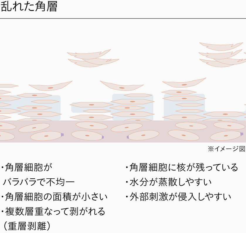 乱れた角層