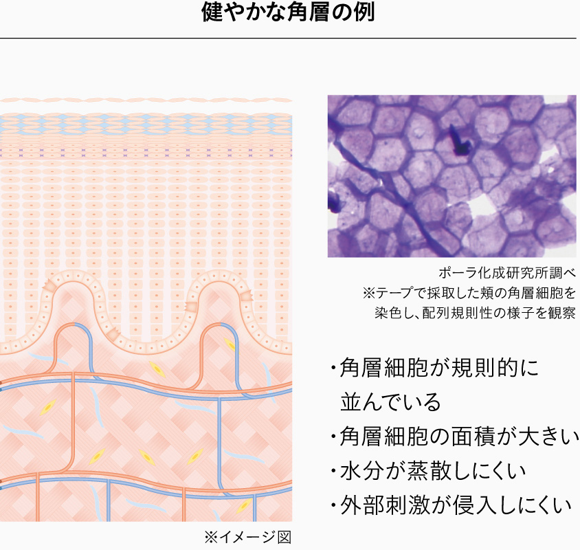 健やかな角層の例