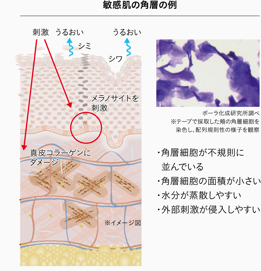 敏感肌の角層の例