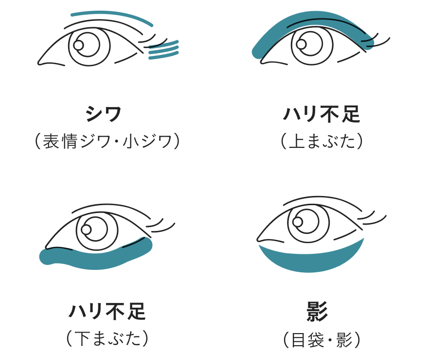 目もと悩みフォルムの印象は、​加齢により変化する。​