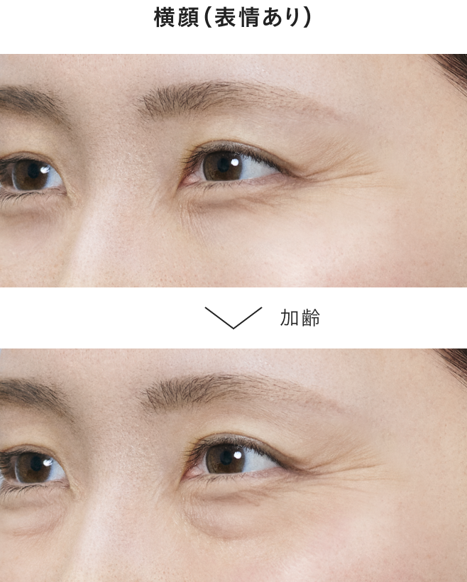 笑顔の印象も加齢とともに変化。目袋や影などの影響で印象が変わっていきます。