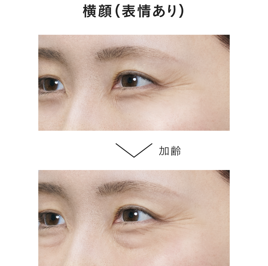 笑顔の印象も加齢とともに変化。目袋や影などの影響で印象が変わっていきます。