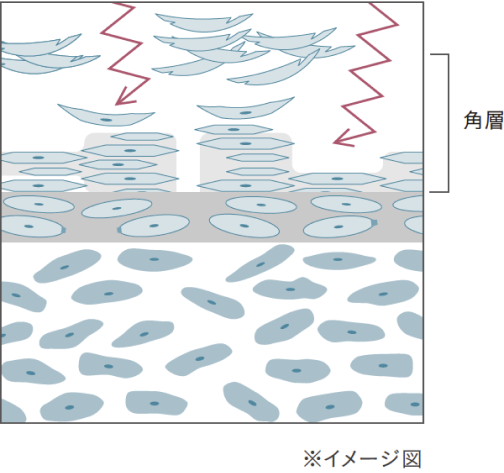 乱れた角層