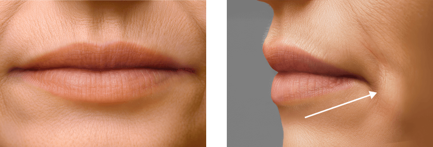 平均的な60代の唇イメージ