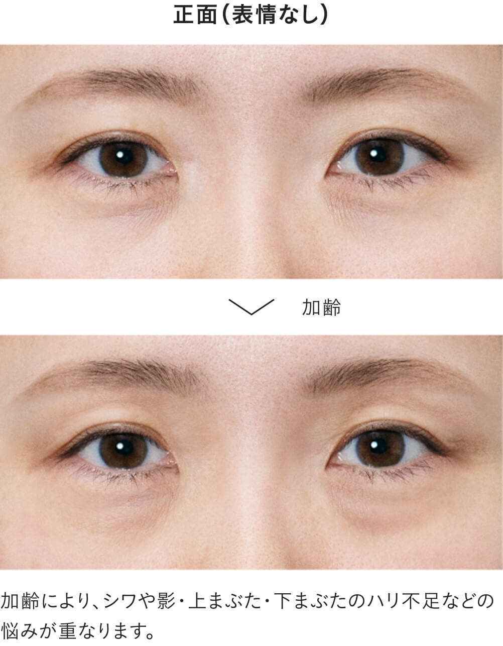 目もとは、年齢感が出やすいゾーンです