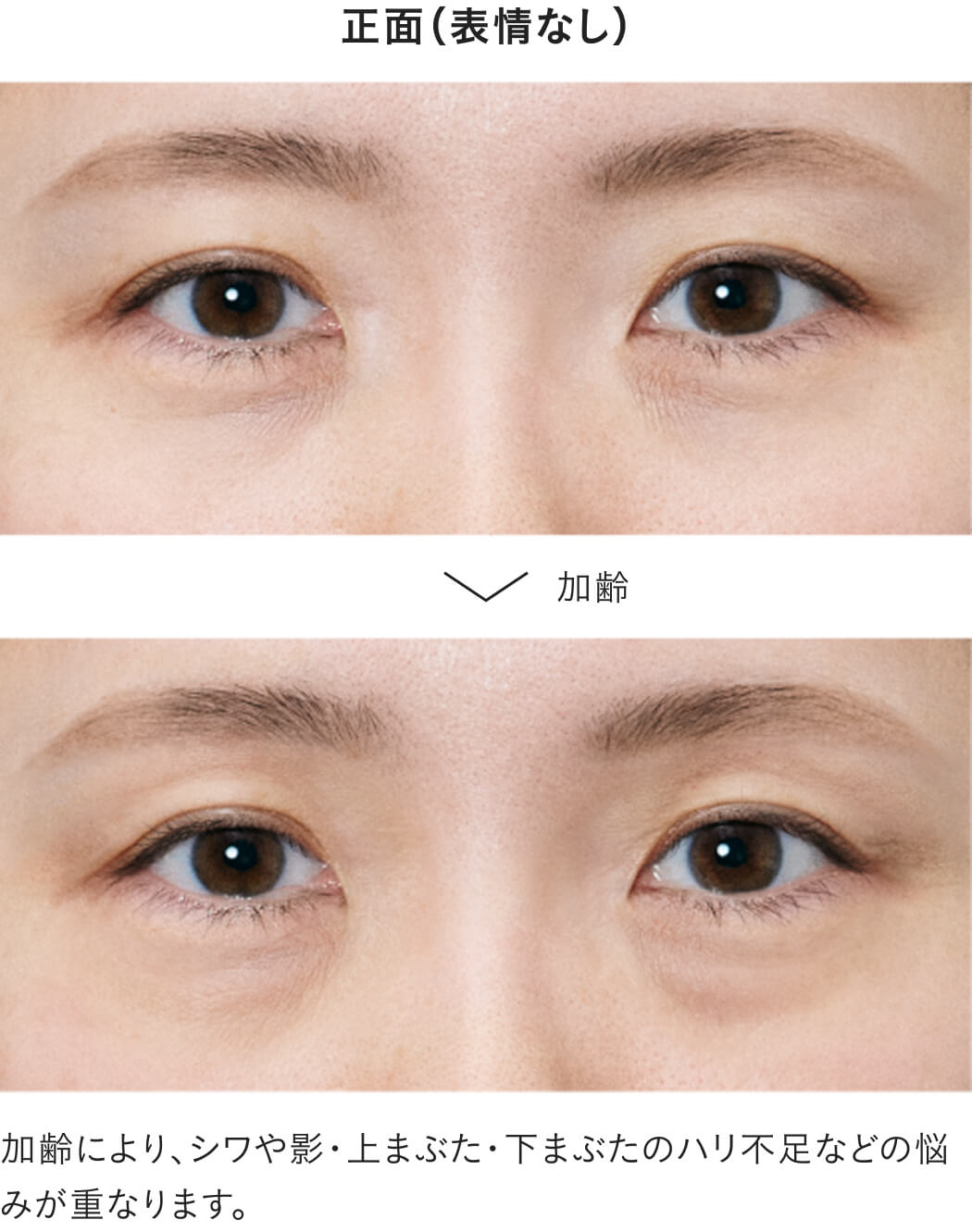 目もとは、年齢感が出やすいゾーンです