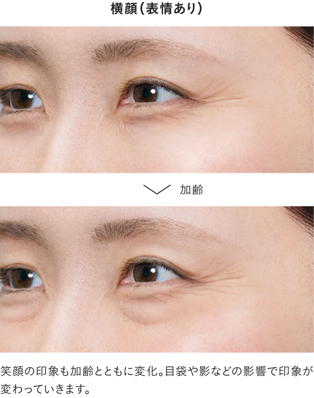 目もとは、年齢感が出やすいゾーンです