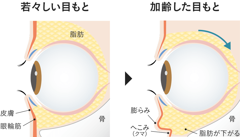 目もとの年齢感は、「構造」の変化が大きな要因