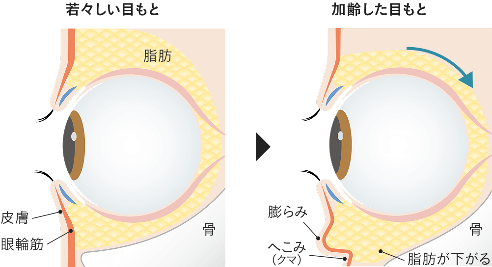 目もとの年齢感は、「構造」の変化が大きな要因