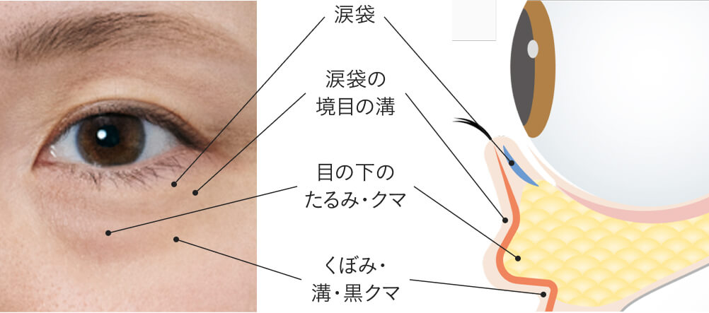 目もとの年齢感は、「構造」の変化が大きな要因