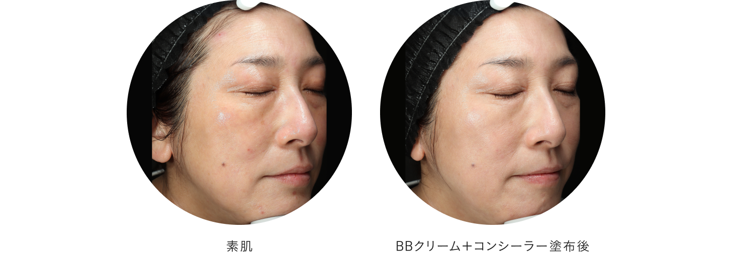 “赤みがとってもきれいに隠れました。そしてスキンケアの重要性にもハッとしました！（樋口）”