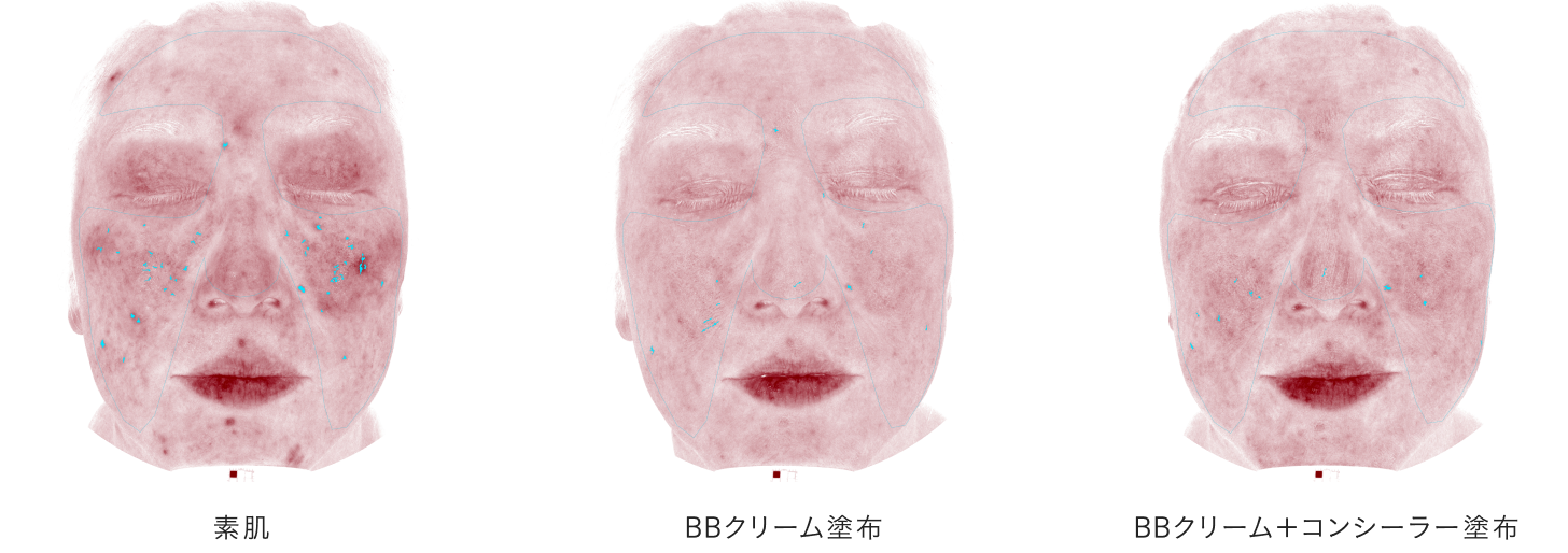 “赤みがとってもきれいに隠れました。そしてスキンケアの重要性にもハッとしました！（樋口）”