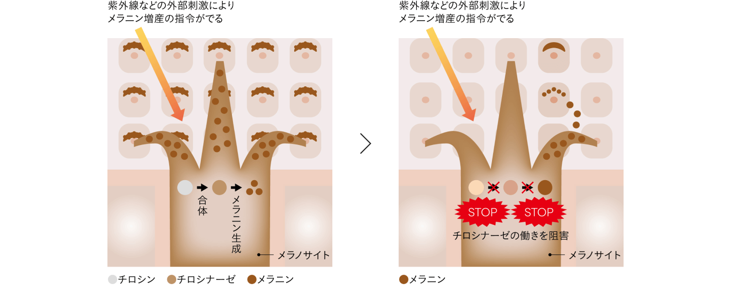 シミ・そばかすの予防に アルブチン