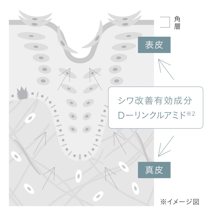 できてしまったシワも。