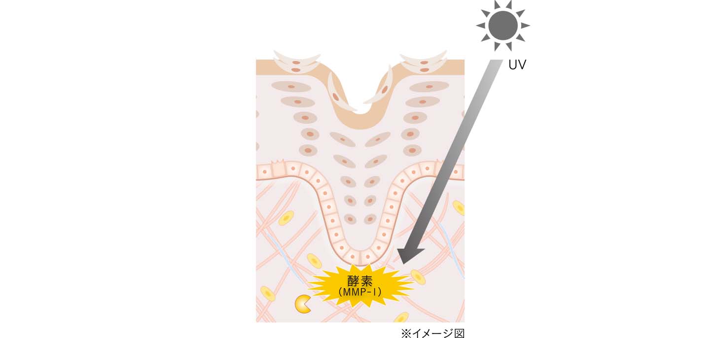 一方で、紫外線は、角層・表皮・基底膜を通り越してさきほどの真皮の細胞にダメージを与えます。ダメージを受けた真皮の細胞はコラーゲンを破壊する酵素（MMP-1）を過剰に放出します。