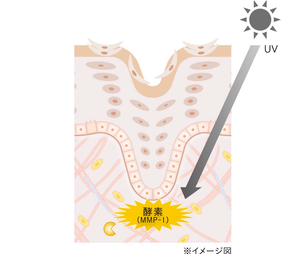 一方で、紫外線は、角層・表皮・基底膜を通り越してさきほどの真皮の細胞にダメージを与えます。ダメージを受けた真皮の細胞はコラーゲンを破壊する酵素（MMP-1）を過剰に放出します。