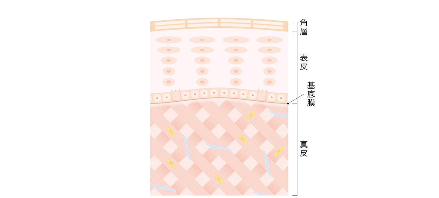 イメージ図