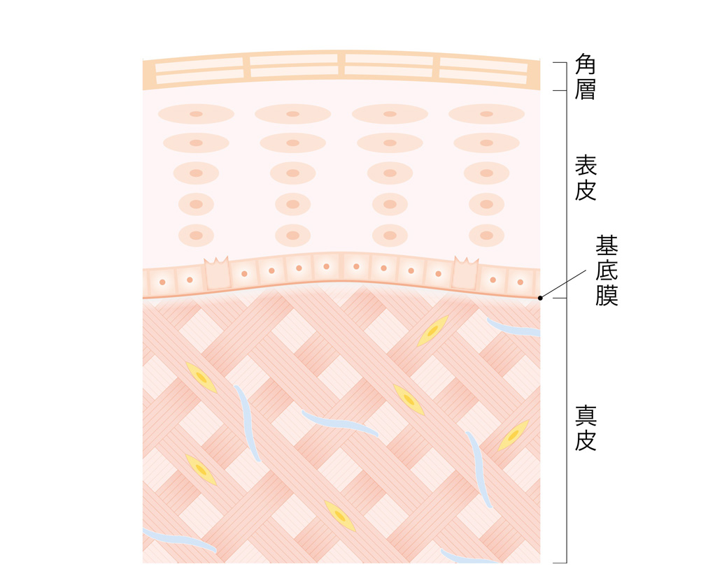 イメージ図