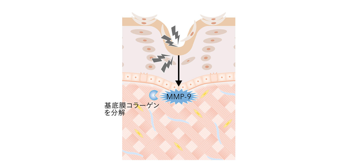 表皮・基底膜が崩れる