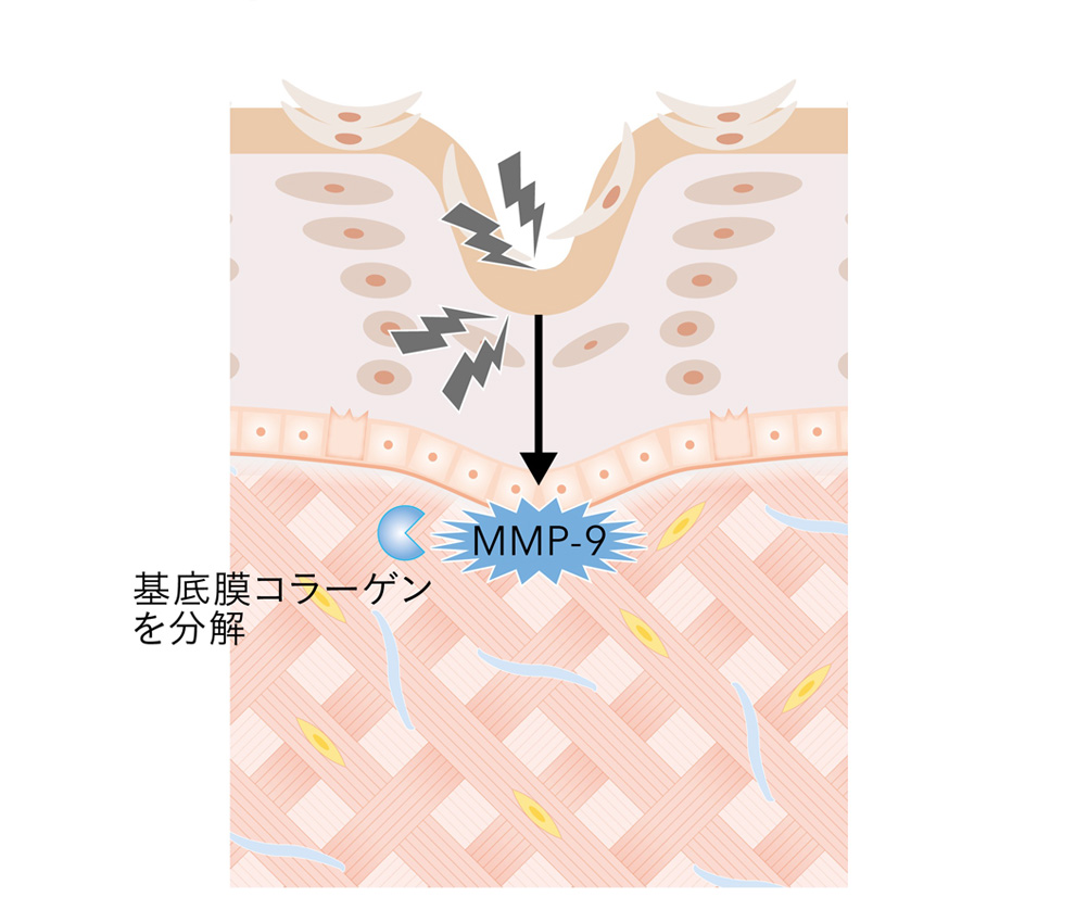 表皮・基底膜が崩れる