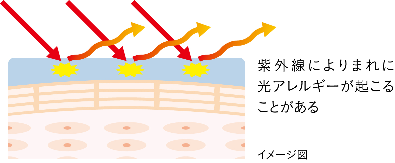 イメージ図紫外線によりまれに光アレルギーが起こることがある