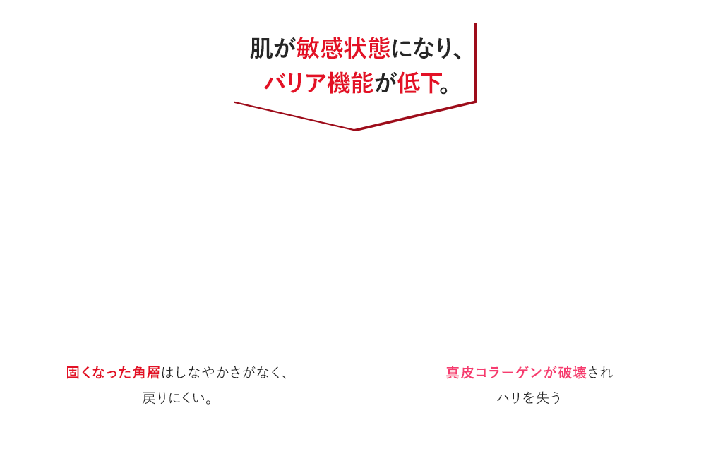 肌が敏感状態になり、バリア機能が低下。表皮エリア-固くなった角層はしなやかさがなく、戻りにくい。 真皮エリア-真皮コラーゲンが破壊されハリを失う