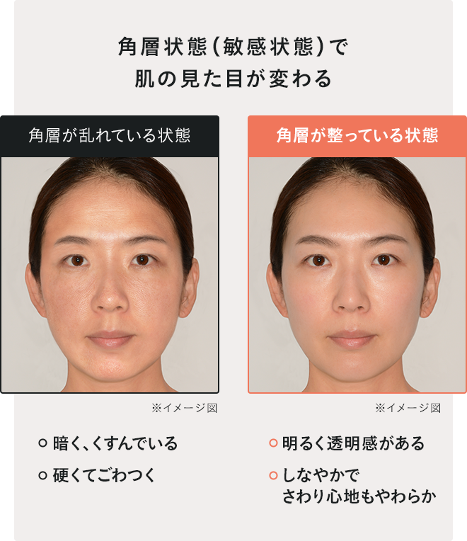 角層状態（敏感状態）で肌の見た目が変わる