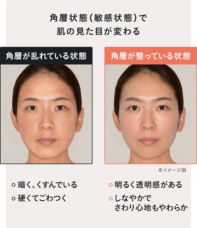 角層状態（敏感状態）で肌の見た目が変わる